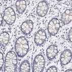 Immunohistochemical staining of human rectum shows low expression as expected.