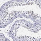 Immunohistochemical staining of human testis shows high expression.