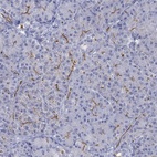 Anti-CFTR Antibody