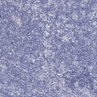 Anti-CFTR Antibody