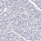 Anti-CCDC70 Antibody