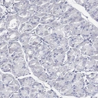 Immunohistochemical staining of human stomach shows low expression as expected.