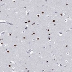 Anti-MAPK8IP1 Antibody