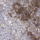 Anti-PCSK1 Antibody
