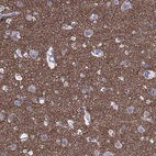 Anti-SYP Antibody