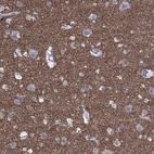 Anti-SYP Antibody