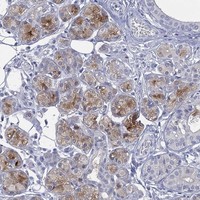 Anti-C5orf46 Antibody