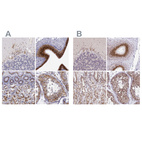 Anti-GOLGA5 Antibody