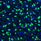 Immunofluorescence staining of mouse thalamus shows positivity in neuronal cell bodies in ventral anterior nucleus.