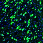 Immunofluorescence staining of mouse globus pallidus shows positivity in neuronal cell bodies.