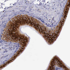 Immunohistochemical staining of human epididymis shows strong positivity in Golgi apparatus in glandular cells.