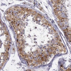 Immunohistochemical staining of human testis shows moderate to strong granular cytoplasmic positivity in cells in seminiferous ducts.