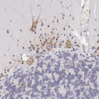 Immunohistochemical staining of human cerebellum shows moderate granular cytoplasmic positivity in Purkinje cells.