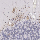 Immunohistochemical staining of human cerebellum shows moderate granular cytoplasmic positivity in Purkinje cells.