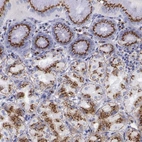 Immunohistochemical staining of human stomach shows moderate to strong granular cytoplasmic positivity in glandular cells.