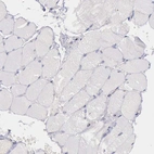 Immunohistochemical staining of human skeletal muscle shows no positivity in myocytes as expected.