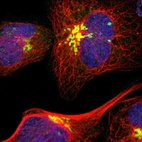 Immunofluorescent staining of human cell line U-2 OS shows localization to the Golgi apparatus.