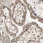 Immunohistochemical staining of human placenta shows strong nuclear positivity in trophoblastic cells.