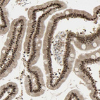 Immunohistochemical staining of human duodenum shows strong nuclear positivity in glandular cells.
