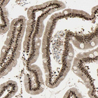 Anti-RBM25 Antibody