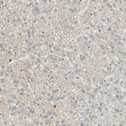 Immunohistochemical staining of human liver shows no positivity in hepatocytes as expected.