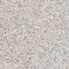 Immunohistochemical staining of human liver shows no positivity in hepatocytes as expected.
