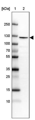 Anti-RBM25 Antibody
