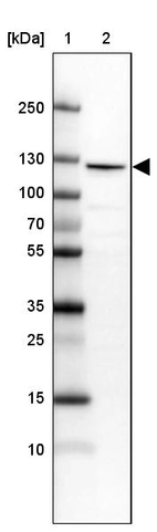 Lane 1: Marker [kDa] 250, 130, 100, 70, 55, 35, 25, 15, 10_br/_Lane 2: Human cell line MOLT-4