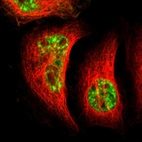 Immunofluorescent staining of human cell line A-431 shows localization to nuclear speckles.