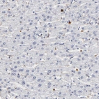 Immunohistochemical staining of human liver shows no positivity in hepatocytes as expected.