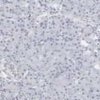 Immunohistochemical staining of human pancreas shows no positivity in exocrine glandular cells as expected.