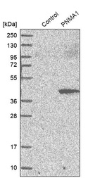 Anti-PNMA1 Antibody