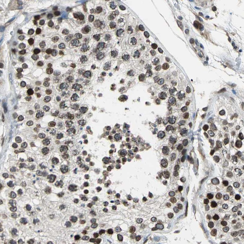 Anti-BRIP1 Antibody