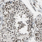 Anti-BRIP1 Antibody