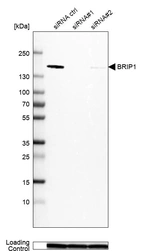 Western blot analysis in MCF-7 cells transfected with control siRNA, target specific siRNA probe #1 and #2, using Anti-BRIP1 antibody. Remaining relative intensity is presented. Loading control: Anti-GAPDH.