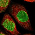 Immunofluorescent staining of human cell line A-431 shows positivity in nucleus & nuclear membrane.