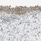 Immunohistochemical staining of human urinary bladder shows weak nuclear positivity in urothelial cells.