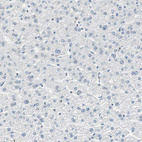 Immunohistochemical staining of human liver shows low positivity in hepatocytes as expected.