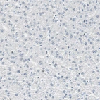 Immunohistochemical staining of human liver shows low positivity in hepatocytes as expected.
