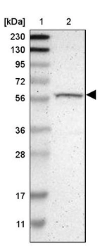 Lane 1: Marker [kDa] 230, 130, 95, 72, 56, 36, 28, 17, 11_br/_Lane 2: Human cell line RT-4