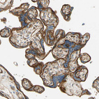Immunohistochemical staining of human placenta shows strong membranous and cytoplasmic positivity in trophoblastic cells.