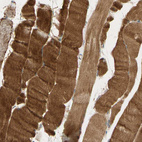 Immunohistochemical staining of human skeletal muscle shows strong cytoplasmic positivity in myocytes.