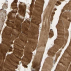 Immunohistochemical staining of human skeletal muscle shows strong cytoplasmic positivity in myocytes.
