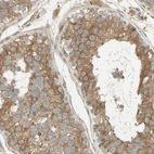 Immunohistochemical staining of human testis shows moderate membranous and cytoplasmic positivity in cells in seminiferous ducts.