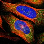Immunofluorescent staining of human cell line U-2 OS shows positivity in cytoplasm.