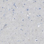 Immunohistochemical staining of human cerebral cortex shows low expression as expected.