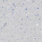 Anti-FCRL1 Antibody