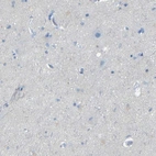 Immunohistochemical staining of human cerebral cortex shows low expression as expected.