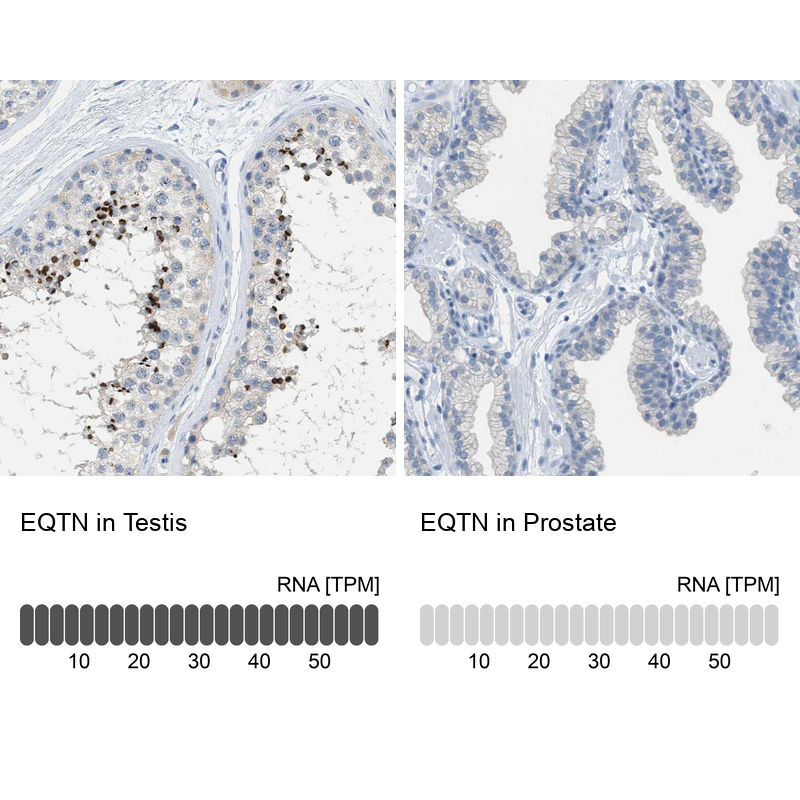 Anti-EQTN Antibody