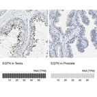 Anti-EQTN Antibody